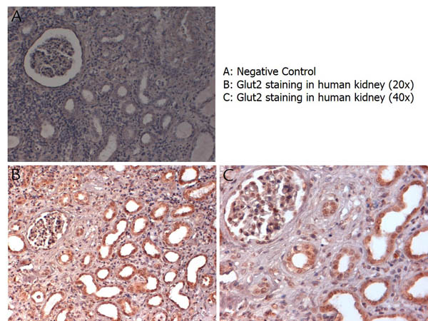 SLC2A2 / GLUT2 Antibody - Immunohistochemistry with anti-Glut2 antibody showing Glut2 staining in nucleus and cytoplasm of ductal epithelium and of renal glomeruli in human kidney at 20x and 40x (B & C). Formalin fixed/paraffin embedded sections were subjected to heat induced epitope retrieval (HIER) at pH 6.2 and then incubated with rabbit anti-mouse Glut2 antibody at 4.0 µg/ml for 60 minutes. The reaction was developed using MACH 1 universal HRP polymer detection system and visualized with 3’3-diamino-benzidine substrate (DAB).