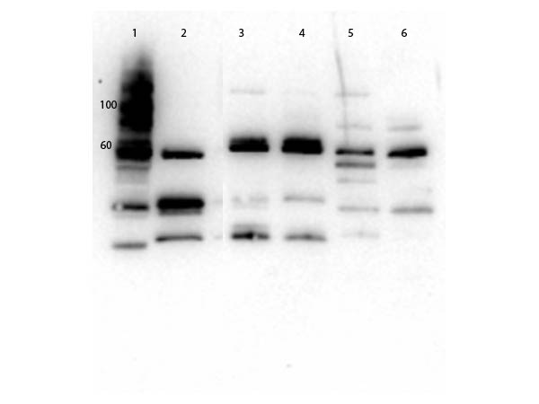 SLC2A2 / GLUT2 Antibody - Western Blot of rabbit Anti-Glut2 Antibody. Lane 1: Molecular Weight. Lane 2: Mouse Kidney WCL. Lane 3: MEF WCL. Lane 4: 3T3 WCL. Lane 5: HeLa WCL. Lane 6: HEK293 WCL. Load: 20µg per pane. Primary antibody: 1µg/mL blocked with MB-073 overnight at 2-8°C. Secondary Antibody: Goat anti-Rabbit HRP 1:40,000 diluted with MB-073 for 30 minutes at RT. Expect: ~57.1 kDa.