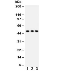 SLC2A2 / GLUT2 Antibody