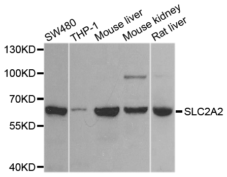 SLC2A2 / GLUT2 Antibody - Western blot analysis of extracts of various cell lines.