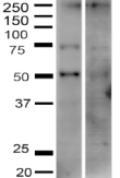 SLC2A2 / GLUT2 Antibody - Detection of GLUT2 in HeLa cell lysate (left) and human 293T cell lysate (right) with GLUT2 Polyclonal Antibody diluted 1:1,000.