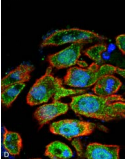 SLC2A2 / GLUT2 Antibody - Detection of GLUT2 in human Colon cancer cell line (HT-29) with GLUT2 Polyclonal Antibody diluted 1:100. DAPI (blue) nuclear stain, Texas red actin stain, and FITC (green) BDNF stain.