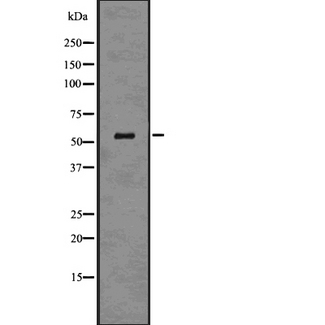 SLC2A2 / GLUT2 Antibody - Western blot analysis glut2 using HuvEc whole cells lysates