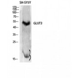 SLC2A3 / GLUT3 Antibody - Western blot of Glut3 antibody