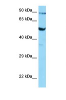 SLC2A3 / GLUT3 Antibody - SLC2A3 / GLUT3 antibody Western blot of COL0205 Cell lysate. Antibody concentration 1 ug/ml.  This image was taken for the unconjugated form of this product. Other forms have not been tested.