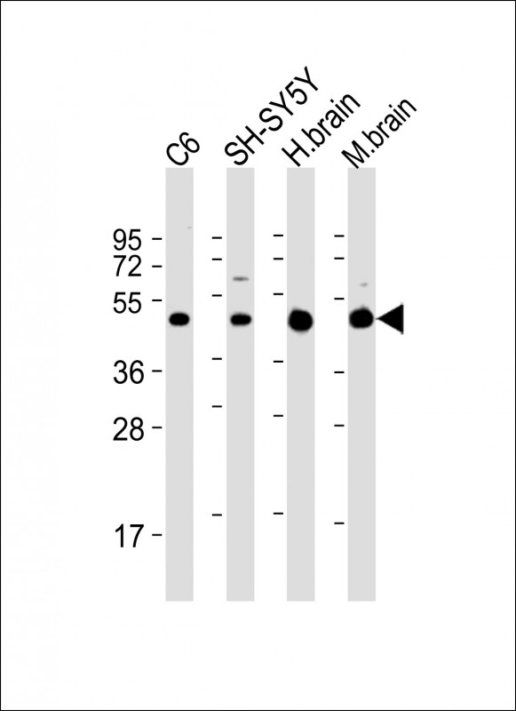 SLC2A3 / GLUT3 Antibody - All lanes: Anti-SLC2A3 Antibody (C-Term) at 1:2000 dilution Lane 1: C6 whole cell lysate Lane 2: SH-SY5Y whole cell lysate Lane 3: human brain lysate Lane 4: mouse brain lysate Lysates/proteins at 20 µg per lane. Secondary Goat Anti-Rabbit IgG, (H+L), Peroxidase conjugated at 1/10000 dilution. Predicted band size: 54 kDa Blocking/Dilution buffer: 5% NFDM/TBST.