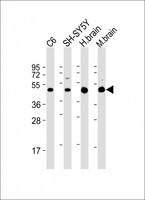 SLC2A3 / GLUT3 Antibody - All lanes: Anti-SLC2A3 Antibody (C-Term) at 1:2000 dilution Lane 1: C6 whole cell lysate Lane 2: SH-SY5Y whole cell lysate Lane 3: human brain lysate Lane 4: mouse brain lysate Lysates/proteins at 20 µg per lane. Secondary Goat Anti-Rabbit IgG, (H+L), Peroxidase conjugated at 1/10000 dilution. Predicted band size: 54 kDa Blocking/Dilution buffer: 5% NFDM/TBST.