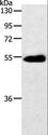SLC2A3 / GLUT3 Antibody - Western blot analysis of Human colon cancer tissue, using SLC2A3 Polyclonal Antibody at dilution of 1:400.