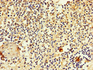 SLC2A3 / GLUT3 Antibody - Immunohistochemistry of paraffin-embedded human spleen tissue at dilution of 1:100