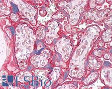 SLC2A3 / GLUT3 Antibody - Human Placenta: Formalin-Fixed, Paraffin-Embedded (FFPE)