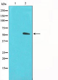 SLC2A3 / GLUT3 Antibody - Western blot analysis on LOVO cells cell lysates using GLUT3 antibody. The lane on the left is treated with the antigen-specific peptide.