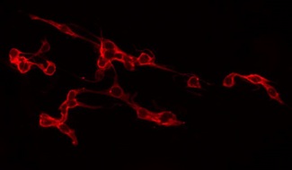 SLC2A3 / GLUT3 Antibody - Staining LOVO cells by IF/ICC. The samples were fixed with PFA and permeabilized in 0.1% Triton X-100, then blocked in 10% serum for 45 min at 25°C. The primary antibody was diluted at 1:200 and incubated with the sample for 1 hour at 37°C. An Alexa Fluor 594 conjugated goat anti-rabbit IgG (H+L) Ab, diluted at 1/600, was used as the secondary antibody.