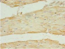 SLC2A4 / GLUT-4 Antibody - Immunohistochemistry of paraffin-embedded human skeletal muscle tissue using antibody at 1:100 dilution.  This image was taken for the unconjugated form of this product. Other forms have not been tested.