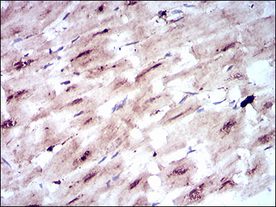 SLC2A4 / GLUT-4 Antibody - IHC of paraffin-embedded cardiac muscle tissues using SLC2A4 mouse monoclonal antibody with DAB staining.