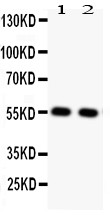 SLC2A4 / GLUT-4 Antibody - GLUT4 antibody Western blot. All lanes: Anti GLUT4 at 0.5 ug/ml. Lane 1: Rat Cardiac Muscle Tissue Lysate at 50 ug. Lane 2: Rat Skeletal Muscle Tissue Lysate at 50 ug. Predicted band size: 55 kD. Observed band size: 55 kD.