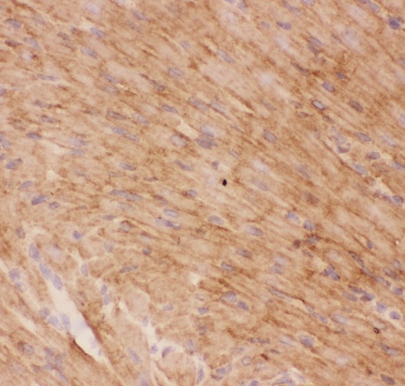 SLC2A4 / GLUT-4 Antibody - GLUT4 antibody IHC-frozen: Rat Cardiac Muscle Tissue.