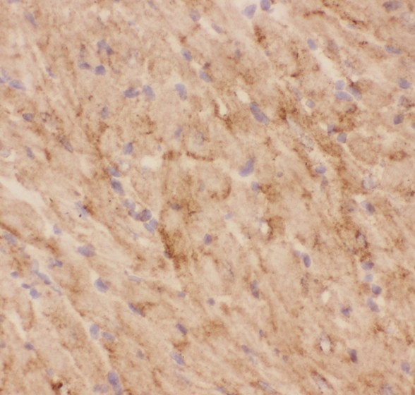 SLC2A4 / GLUT-4 Antibody - GLUT4 antibody IHC-frozen: Mouse Cardiac Muscle Tissue.