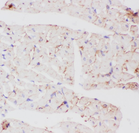 SLC2A4 / GLUT-4 Antibody - GLUT4 antibody IHC-paraffin: Rat Cardiac Muscle Tissue.