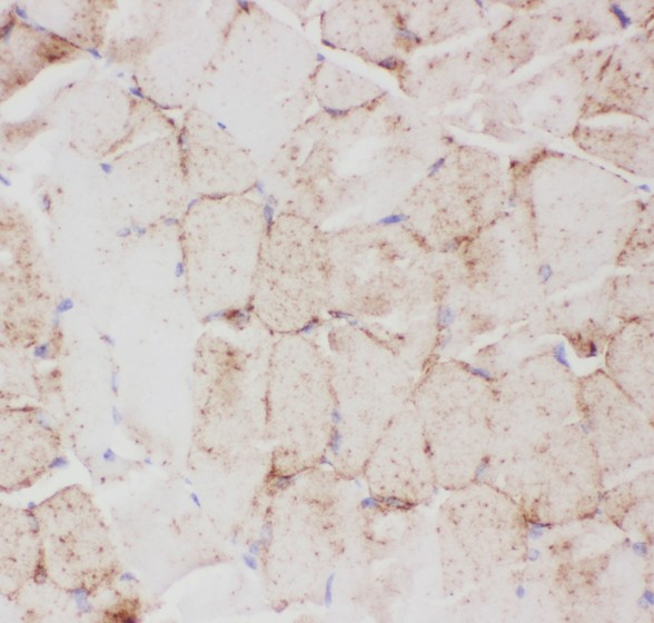 SLC2A4 / GLUT-4 Antibody - GLUT4 antibody IHC-paraffin: Mouse Skeletal Muscle Tissue.