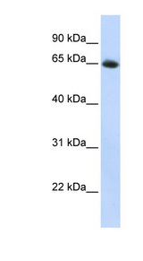 SLC2A4 / GLUT-4 Antibody - SLC2A4 / GLUT4 antibody Western blot of HepG2 cell lysate. This image was taken for the unconjugated form of this product. Other forms have not been tested.