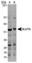 SLC2A4 / GLUT-4 Antibody - Glucose Transporter GLUT4 Antibody - Western blot of GLUT4 in A. MCF7 whole cell lysate and B. 3T3L1 whole cell lysate.  This image was taken for the unconjugated form of this product. Other forms have not been tested.