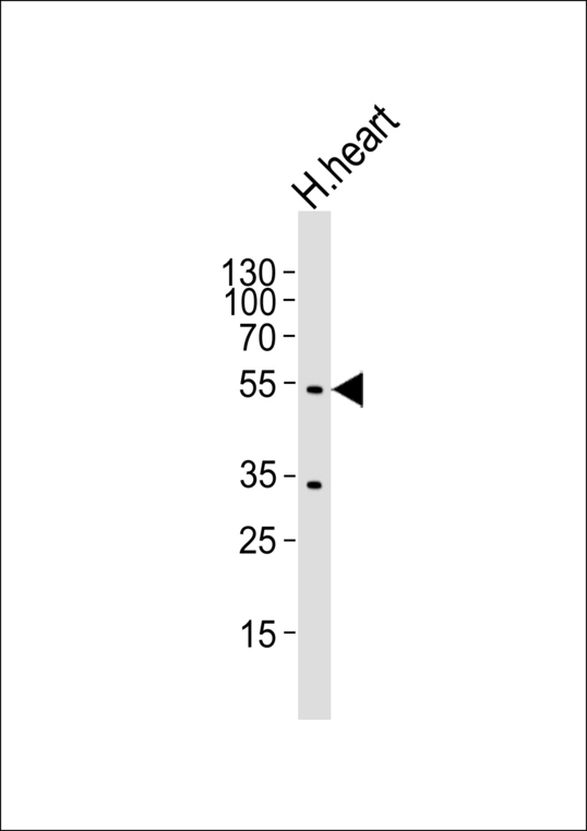 SLC2A4 / GLUT-4 Antibody - Western blot of lysate from human heart tissue with SLC2A4 Antibody. Antibody was diluted at 1:1000. A goat anti-rabbit IgG H&L (HRP) at 1:5000 dilution was used as the secondary antibody. Lysate at 35 ug.