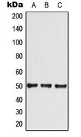 SLC2A4 / GLUT-4 Antibody - Western blot analysis of GLUT4 expression in A549 (A); HeLa (B); NIH3T3 (C) whole cell lysates.