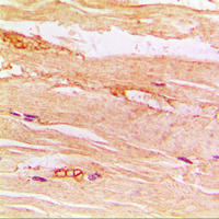 SLC2A4 / GLUT-4 Antibody - Immunohistochemical analysis of GLUT4 staining in human muscle formalin fixed paraffin embedded tissue section. The section was pre-treated using heat mediated antigen retrieval with sodium citrate buffer (pH 6.0). The section was then incubated with the antibody at room temperature and detected using an HRP conjugated compact polymer system. DAB was used as the chromogen. The section was then counterstained with hematoxylin and mounted with DPX.