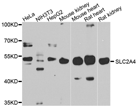 SLC2A4 / GLUT-4 Antibody - Western blot analysis of extracts of various cells.
