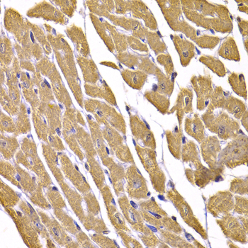SLC2A4 / GLUT-4 Antibody - Immunohistochemistry of paraffin-embedded mouse heart.