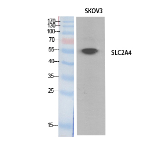 SLC2A4 / GLUT-4 Antibody - Western Blot analysis of extracts from SKOV3 cells using SLC2A4 Antibody.