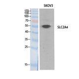 SLC2A4 / GLUT-4 Antibody - Western Blot analysis of extracts from SKOV3 cells using SLC2A4 Antibody.