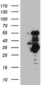 SLC2A4RG / GEF Antibody - HEK293T cells were transfected with the pCMV6-ENTRY control. (Left lane) or pCMV6-ENTRY SLC2A4RG. (Right lane) cDNA for 48 hrs and lysed. Equivalent amounts of cell lysates. (5 ug per lane) were separated by SDS-PAGE and immunoblotted with anti-SLC2A4RG. (1:2000)