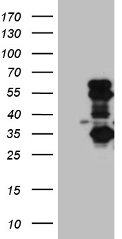 SLC2A4RG / GEF Antibody - HEK293T cells were transfected with the pCMV6-ENTRY control. (Left lane) or pCMV6-ENTRY SLC2A4RG. (Right lane) cDNA for 48 hrs and lysed. Equivalent amounts of cell lysates. (5 ug per lane) were separated by SDS-PAGE and immunoblotted with anti-SLC2A4RG. (1:2000)