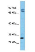SLC2A4RG / GEF Antibody - SLC2A4RG / GEF antibody Western Blot of Thymus Tumor. Antibody dilution: 1 ug/ml.  This image was taken for the unconjugated form of this product. Other forms have not been tested.