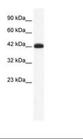 SLC2A4RG / GEF Antibody - Jurkat Cell Lysate.  This image was taken for the unconjugated form of this product. Other forms have not been tested.