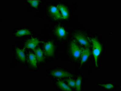 SLC2A4RG / GEF Antibody - Immunofluorescence staining of Hela cells at a dilution of 1:200, counter-stained with DAPI. The cells were fixed in 4% formaldehyde, permeabilized using 0.2% Triton X-100 and blocked in 10% normal Goat Serum. The cells were then incubated with the antibody overnight at 4 °C.The secondary antibody was Alexa Fluor 488-congugated AffiniPure Goat Anti-Rabbit IgG (H+L) .