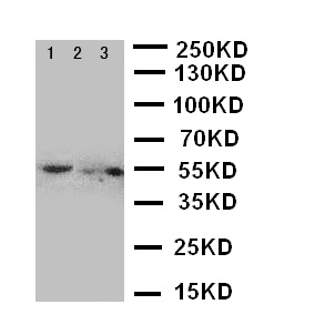 SLC2A5 / GLUT5 Antibody - WB of SLC2A5 / GLUT5 antibody. Lane 1: Rat Kidney Tissue Lysate. Lane 2: Rat liver Tissue Lysate. Lane 3: Mouse Kidney Tissue Lysate.