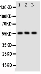 SLC2A5 / GLUT5 Antibody - Anti-SLC2A5 antibody, Western blotting All lanes: Anti SLC2A5 at 0.5ug/ml Lane 1: Rat Kidney Tissue Lysate at 50ugLane 2: Rat Liver Tissue Lysate at 50ugLane 3: Mouse Kidney Tissue Lysate at 50ugPredicted bind size: 55KD Observed bind size: 55KD