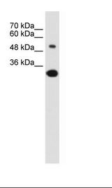 SLC2A5 / GLUT5 Antibody - Jurkat Cell Lysate.  This image was taken for the unconjugated form of this product. Other forms have not been tested.