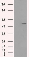 SLC2A5 / GLUT5 Antibody - HEK293T cells were transfected with the pCMV6-ENTRY control (Left lane) or pCMV6-ENTRY SLC2A5 (Right lane) cDNA for 48 hrs and lysed. Equivalent amounts of cell lysates (5 ug per lane) were separated by SDS-PAGE and immunoblotted with anti-SLC2A5.