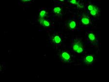 SLC2A5 / GLUT5 Antibody - Anti-SLC2A5 mouse monoclonal antibody  immunofluorescent staining of COS7 cells transiently transfected by pCMV6-ENTRY SLC2A5.