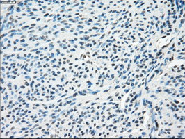SLC2A5 / GLUT5 Antibody - IHC of paraffin-embedded endometrium tissue using anti-SLC2A5 mouse monoclonal antibody. (Dilution 1:50).