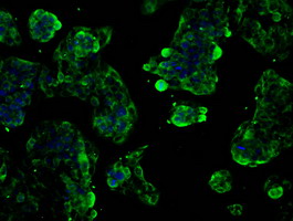 SLC2A5 / GLUT5 Antibody - Immunofluorescent staining of HepG2 cells using anti-SLC2A5 mouse monoclonal antibody.