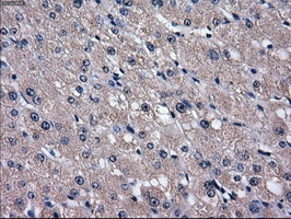 SLC2A5 / GLUT5 Antibody - IHC of paraffin-embedded liver tissue using anti-SLC2A5 mouse monoclonal antibody. (Dilution 1:50).