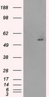 SLC2A5 / GLUT5 Antibody - HEK293T cells were transfected with the pCMV6-ENTRY control (Left lane) or pCMV6-ENTRY SLC2A5 (Right lane) cDNA for 48 hrs and lysed. Equivalent amounts of cell lysates (5 ug per lane) were separated by SDS-PAGE and immunoblotted with anti-SLC2A5.