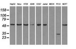 SLC2A5 / GLUT5 Antibody - Western blot analysis of extracts (35ug) from 9 different cell lines by using anti-SLC2A5 monoclonal antibody.