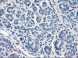 SLC2A5 / GLUT5 Antibody - Immunohistochemical staining of paraffin-embedded breast tissue using anti-SLC2A5 mouse monoclonal antibody. (Dilution 1:50).
