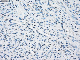 SLC2A5 / GLUT5 Antibody - Immunohistochemical staining of paraffin-embedded endometrium tissue using anti-SLC2A5 mouse monoclonal antibody. (Dilution 1:50).