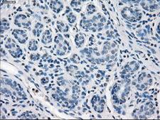 SLC2A5 / GLUT5 Antibody - Immunohistochemical staining of paraffin-embedded breast tissue using anti-SLC2A5 mouse monoclonal antibody. (Dilution 1:50).
